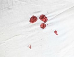 manchas de sangre