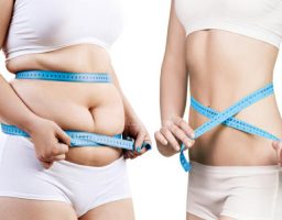 una liposucción sin cirugía