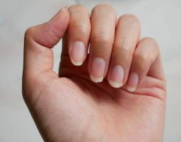 uñas quebradizas