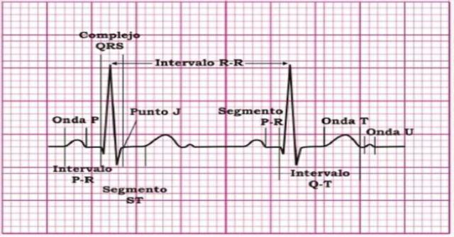interpretar un electrocardiograma